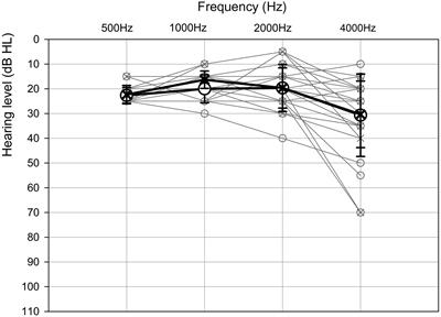 Difficulties Experienced by Older Listeners in Utilizing Voice Cues for Speaker Discrimination
